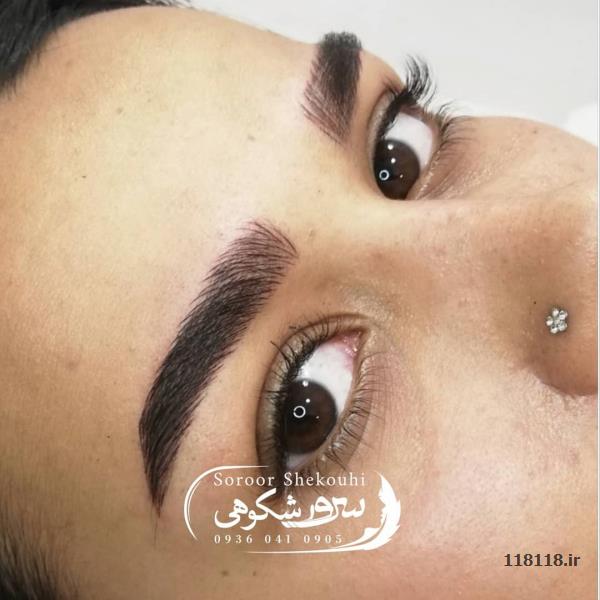 فیبروز ابرو.هاشورمویی،سایه ابرو،اسکالپ سر