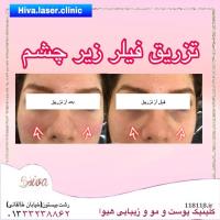 ارائه کلیه  خدمات پوست مو و زیبایی در کلینیک هیوا