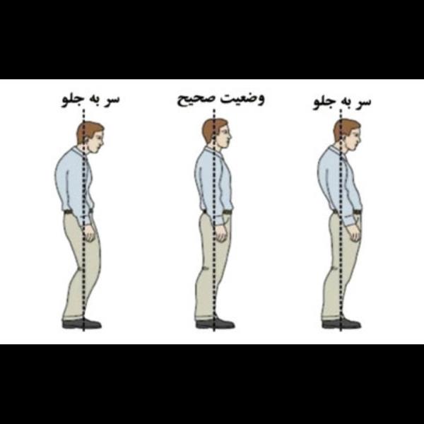 شناخت ناهنجاری‌های اسکلتی ، عضلانی