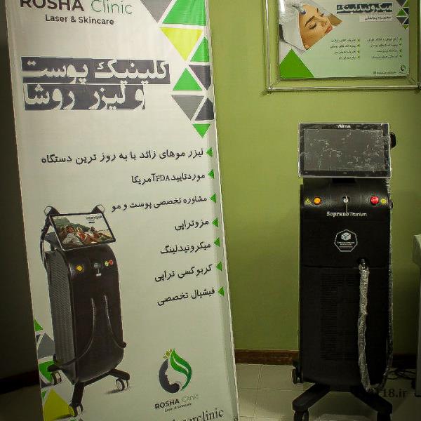 لیزر موهای زاید