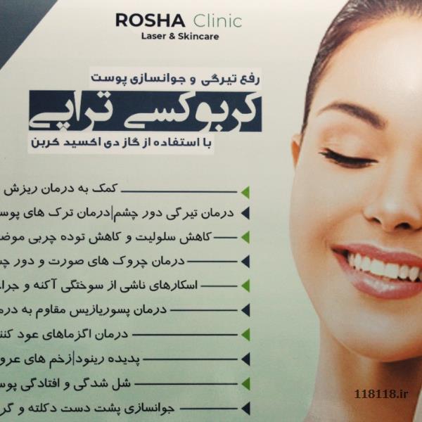 لیزر موهای زاید